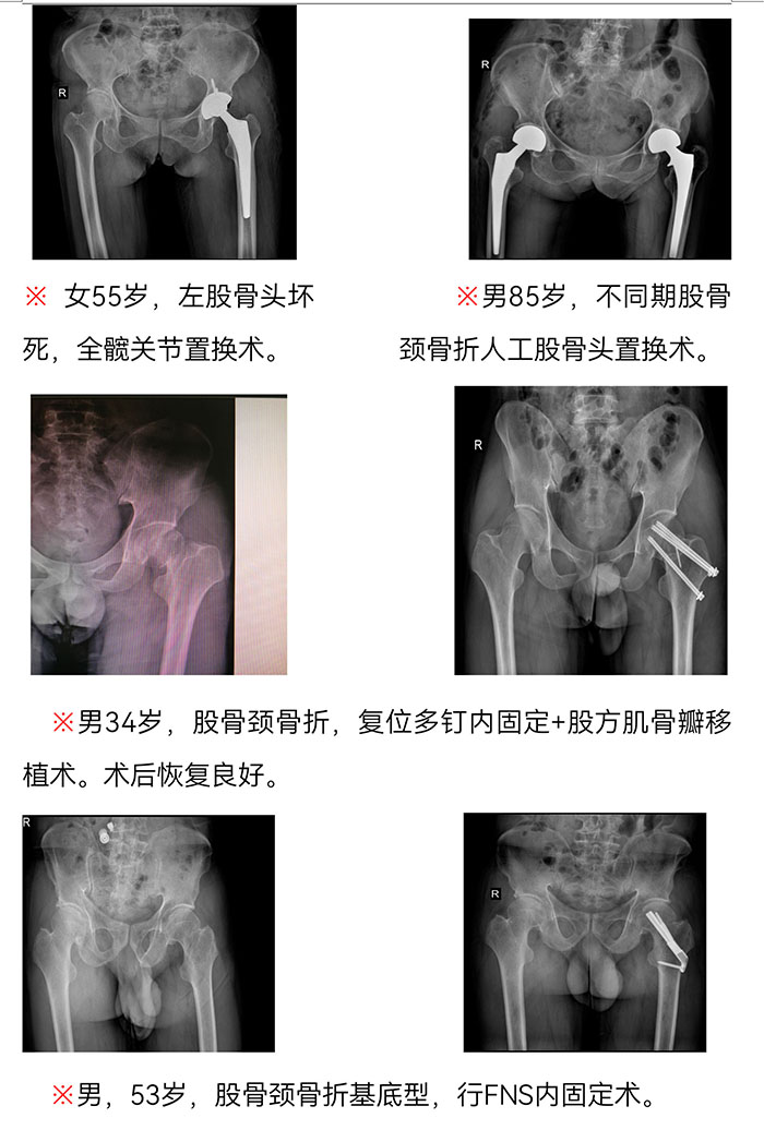 枞阳县中医院骨伤科简介