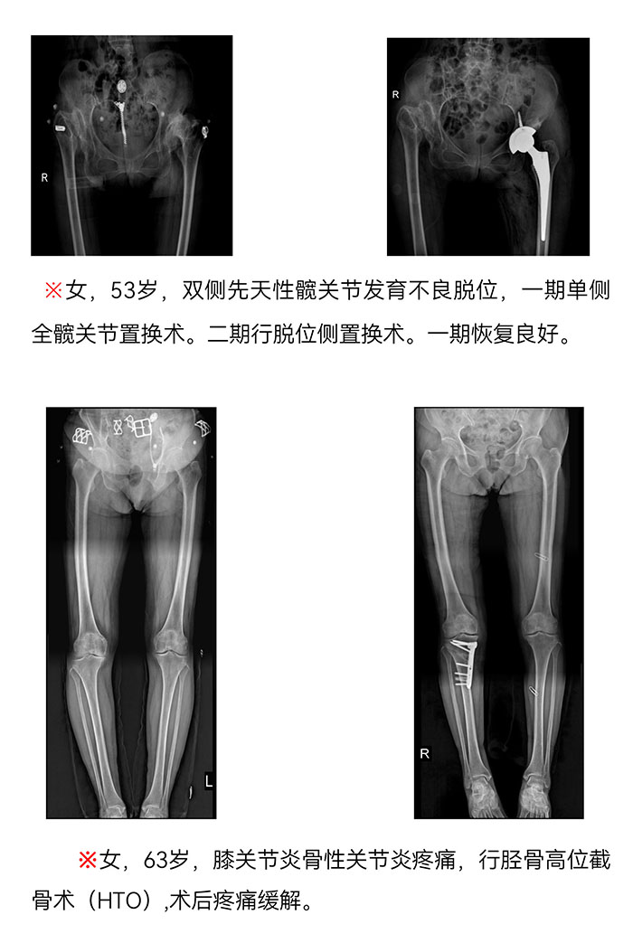 枞阳县中医院骨伤科简介