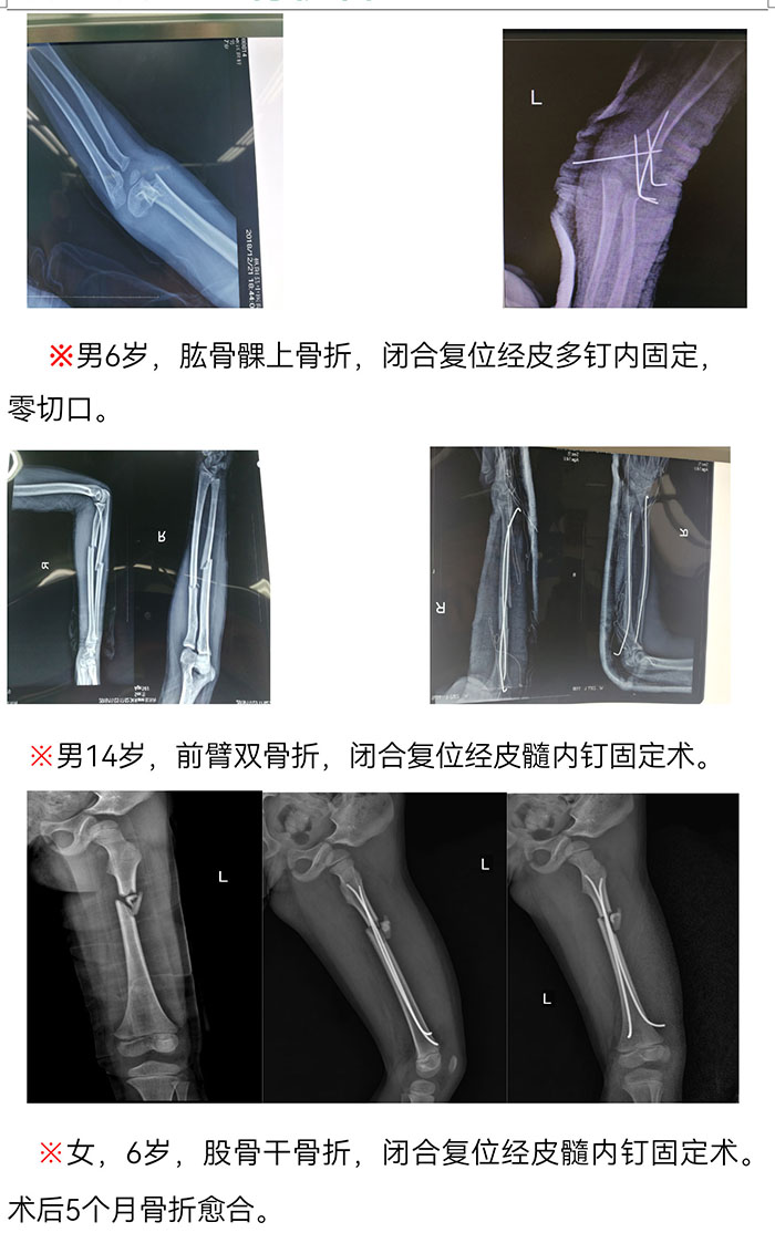 枞阳县中医院骨伤科简介