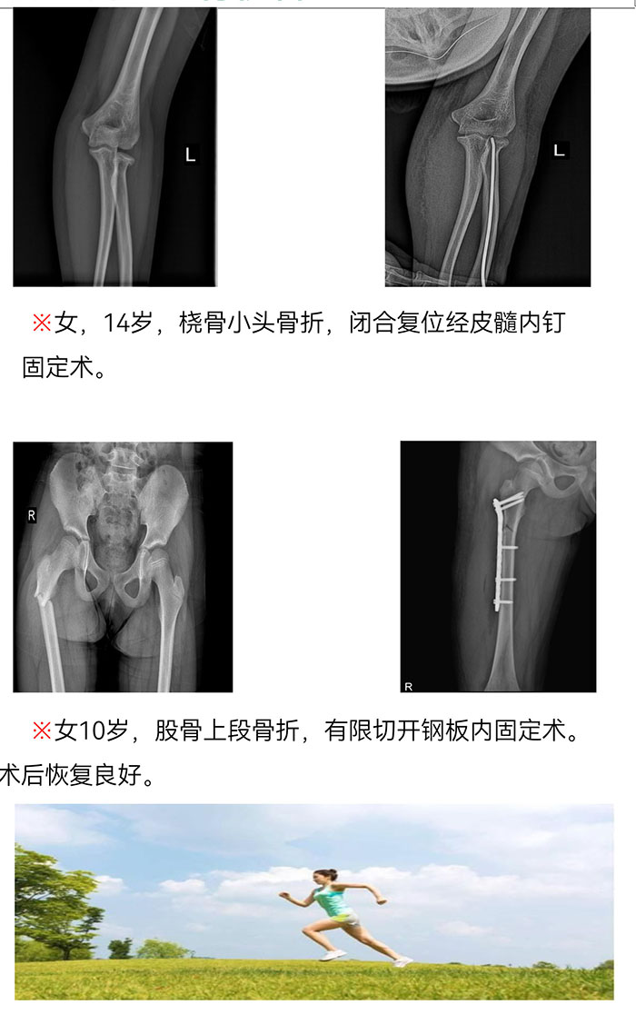 枞阳县中医院骨伤科简介