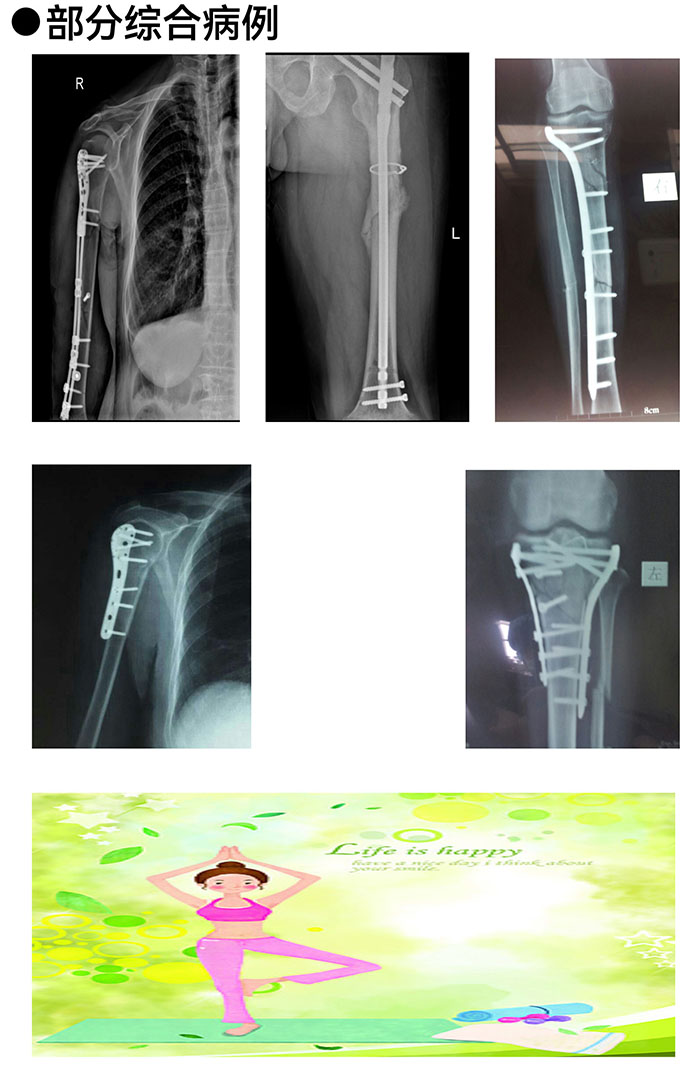 枞阳县中医院骨伤科简介