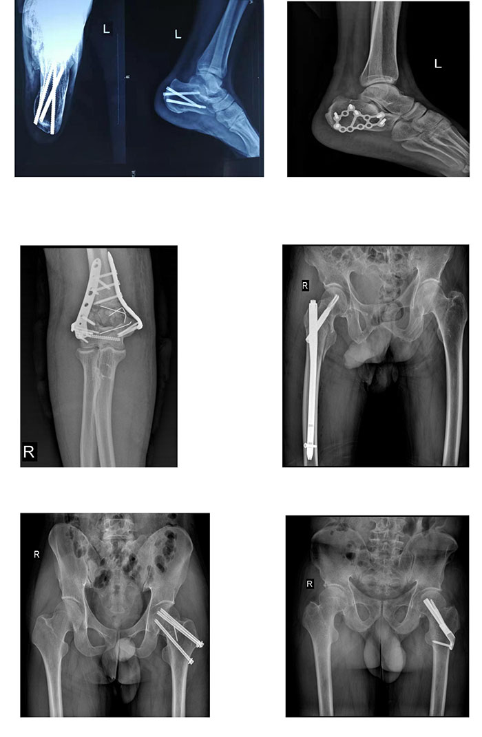 枞阳县中医院骨伤科简介