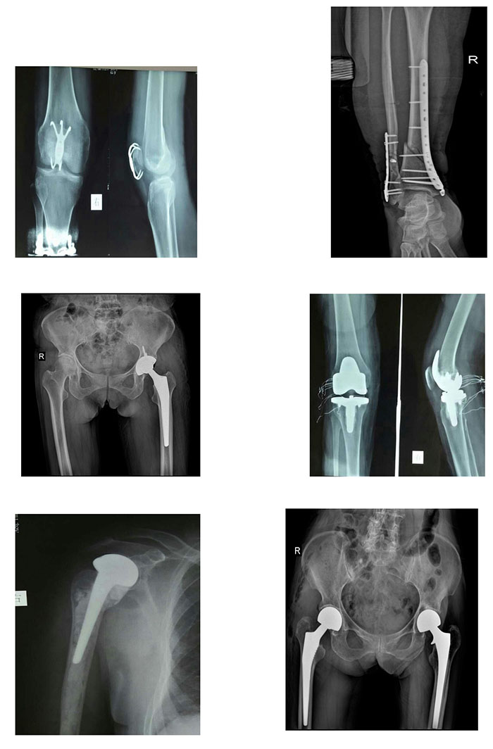 枞阳县中医院骨伤科简介