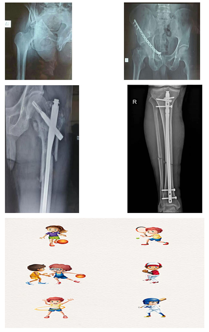 枞阳县中医院骨伤科简介
