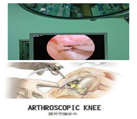 枞阳县中医院骨伤科医疗新动态