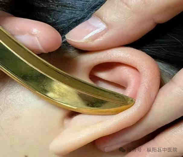 枞阳县中医院中医特色护理门诊开诊啦！