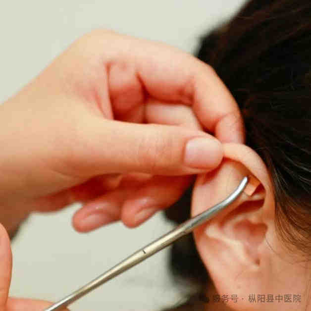 枞阳县中医院中医特色护理门诊开诊啦！